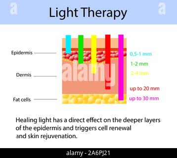 Light therapy diagram, vector illustration with length of waves Stock Vector