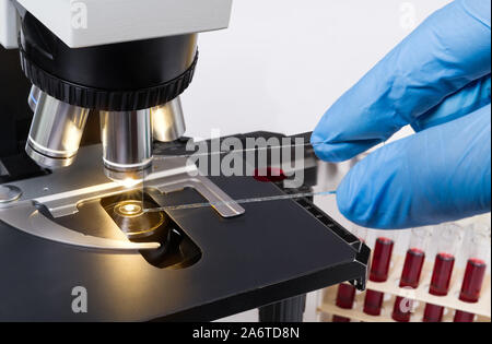 Laboratory medical microscope detail. Hand in blue glove holding red specimen on glass slide. Hematologic, biochemical or veterinary clinical analysis. Stock Photo