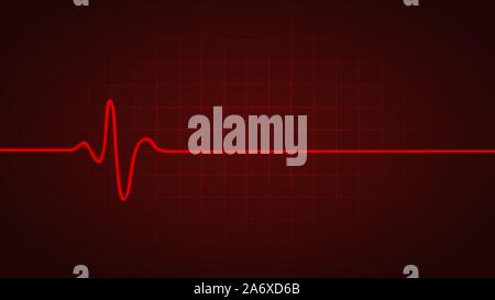 Pulse rate Line while dead on green chart background of monitor ...