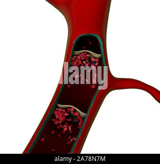 Contraction of blood vessels, a blood clot in the vessels, fat cell in the blood, inside the blood vessel, High quality 3d render of blood cells Stock Photo