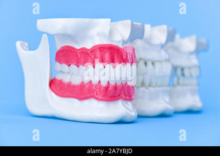 Human jaws with teeth and gums anatomy models medical illustration isolated on blue background. Healthy teeth, dental care and orthodontic concept Stock Photo