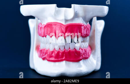 Human jaw with teeth and gums anatomy model medical illustration isolated on blue background. Healthy teeth, dental care and orthodontic concept Stock Photo