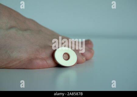 A corn plaster on the little toe of a foot, isolated on white background. Stock Photo