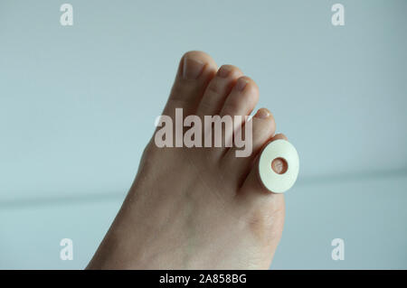 A corn plaster on the little toe of a foot, isolated on white background. Stock Photo