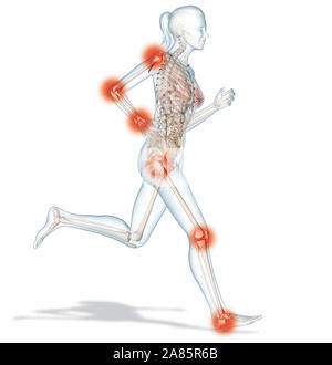 Medically 3D illustration showing painful osteoarthritic joints of a running woman Stock Photo