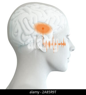 3D illustration showing human ear of a woman with marked auditory cortex and soundwave Stock Photo