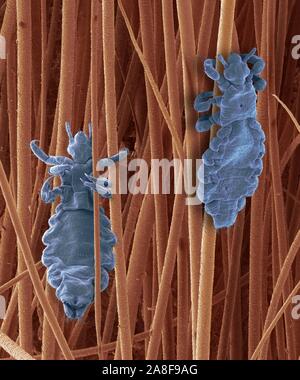 Head lice, SEM Stock Photo