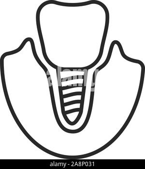 thin line icon of dental implant isolated on white Stock Vector