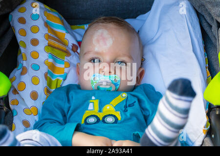 Close up of baby injury. Baby's expression and the scar on the forehead after he hits his head on the ground. Stock Photo