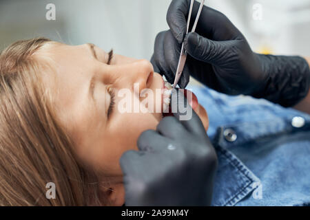 Close up of hands in black rubber gloves holding dental instrument and putting braces for young girl. Female patient sitting with closed eyes and opening mouth. Stock Photo