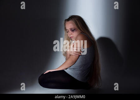 Sad and frightened little girl with bloodshot, bruised eyes sitting scared. Concept of child violence, domestic abuse. Sad, depressed being victim of parents and their agression. Children's rights. Stock Photo