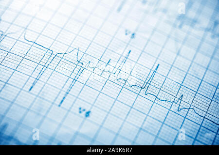 Close up of an electrocardiogram in paper form. Stock Photo