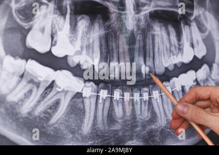 Doctor holding and looking at dental x-ray Stock Photo