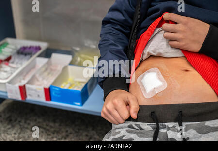 Young teenage boy in hospital. Child with cut wound in medical cabinet in hospital. Kid shows belly wound. Concept for wound from surgery. Stock Photo