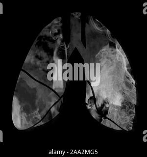 lungs silhouette with smoke inside, 3d illustration Stock Photo