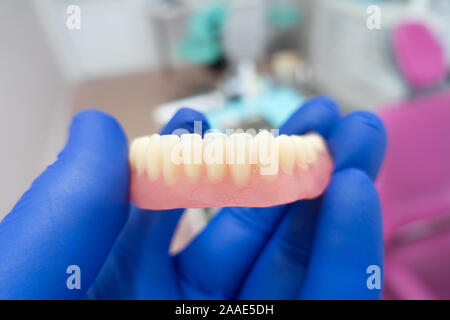 removable denture in the hands of a doctor in blue gloves Stock Photo