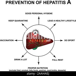 Prevention of Hepatitis A. World Hepatitis Day. Infographics. Vector illustration on isolated background. Stock Vector