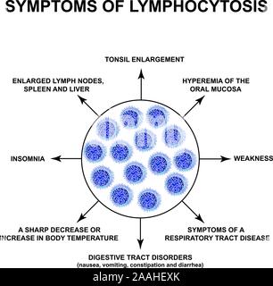 Symptoms of Lymphocytosis. The increase in lymphocytes in the blood. Cell killers. Immunity Helper Cells. Infographics. Vector illustration on Stock Vector