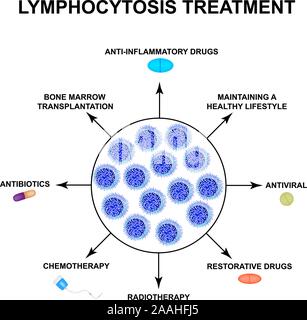 Lymphocytosis treatment. The increase in lymphocytes in the blood. Cell killers. Immunity Helper Cells. Infographics. Vector illustration on isolated Stock Vector