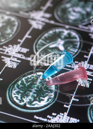 Clinical samples from research project contained in vials with brain scan images, research into Alzheimers and dementia medical conditions. Stock Photo