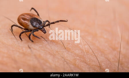Crawling deer tick on human hairy skin background. Ixodes ricinus or scapularis. Dangerous parasitic mite on blurry pink texture. Tick-borne diseases. Stock Photo
