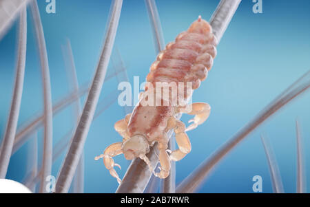 3d rendered illustration of a head louse on a human head Stock Photo