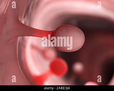 3d rendered medically accurate illustration of colon polyps Stock Photo