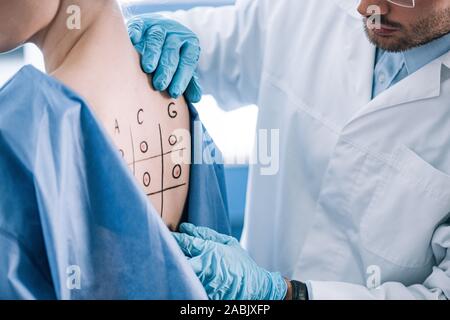 cropped view of allergist touching marked back with numbers and letters Stock Photo