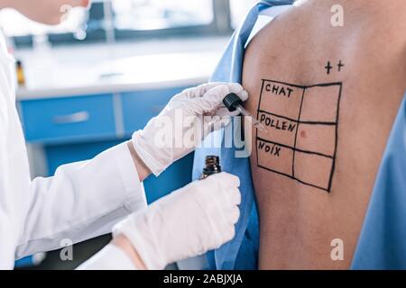 cropped view of allergist in latex gloves holding pipette and glass bottle near man with marked back Stock Photo