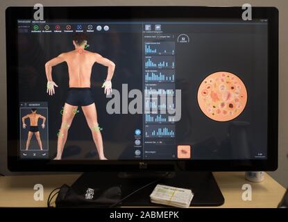 3D Body Scanner - Premier Healthcare Germany