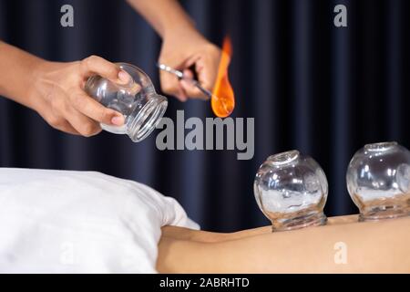 close up glass cup with fire for cupping treatment on female back Stock Photo