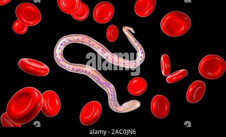 Wuchereria bancrofti parasite, illustration Stock Photo