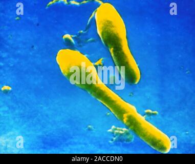 clostridium tetani electron micrograph