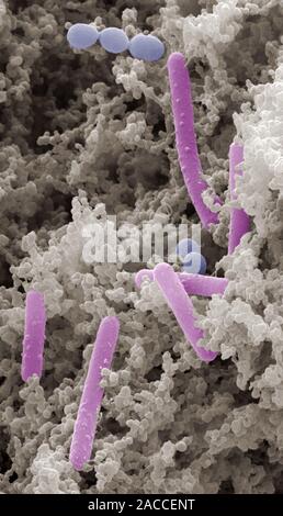 Yoghurt bacteria. Coloured scanning electron micrograph (SEM) of bacteria (coloured) among the milk solids from a yoghurt. There are rod-shaped bacter Stock Photo