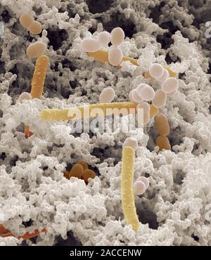 Yoghurt bacteria. Coloured scanning electron micrograph (SEM) of bacteria (coloured) among the milk solids from a yoghurt. There are rod-shaped bacter Stock Photo