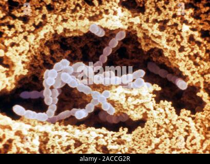 Streptococcus salivarius bacteria. Coloured scann- ing electron micrograph (SEM) of Streptococcus salivarius bacteria (grey). The bacterial chains are Stock Photo