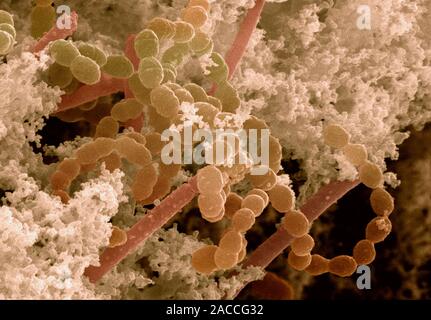 Yoghurt bacteria. Coloured scanning electron micrograph (SEM) of the bacteria Streptococcus thermophilus (spherical) and Lactobacillus bulgar- icus (r Stock Photo
