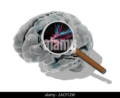 Stroke. Conceptual computer artwork of a stroke, showing a magnifying glass over a burst blood vessel in the brain. A stroke is also known as a cerebr Stock Photo
