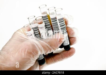 Blood samples held in a gloved hand. The vacutainers are barcoded so that these samples of donated blood can be easily identified throughout their ana Stock Photo