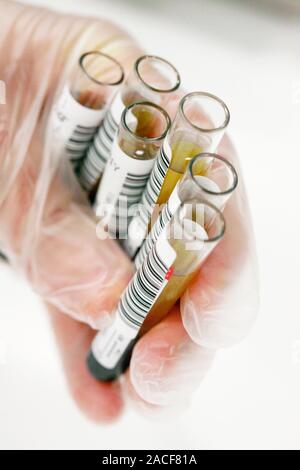 Blood samples held in a gloved hand. The vacutainers are barcoded so that these samples of donated blood can be easily identified throughout their ana Stock Photo