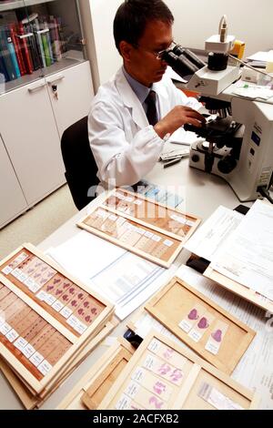 Examining tissue samples. Pathologist examining tissue samples under a microscope. Stock Photo
