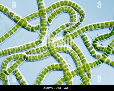 Green algae. Differential interference contrast light micrograph of the green filamentous alga Klebsormidium sp.. This alga is found in freshwater and Stock Photo