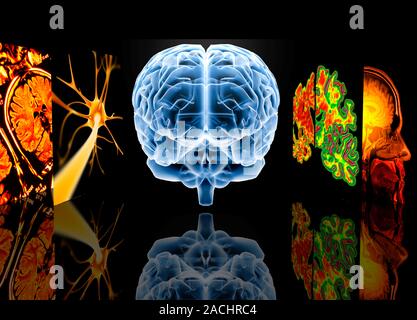 Conceptual computer artwork depicting neurology. From left to right: MRI brain scans, nerve cell, brain, Alzheimer's brain versus normal brain, MRI br Stock Photo