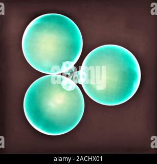 Christmas baubles, X-ray. Stock Photo