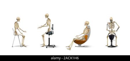 Chair ergonomics. Series of artworks of human skeletons, showing the correct posture for a human when sitting on different types of chair. In all four Stock Photo
