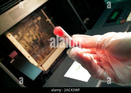 Haematology lab. Technician working with blood samples in a haematology laboratory. Photographed in Antibes, France. Stock Photo
