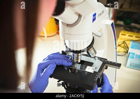 Cancer research laboratory. Researcher looking at a specimen under a microscope in a biochemistry lab. Stock Photo