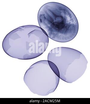 Bird eggs and embryo. X-ray of broken egg shells after hatching, and an egg with a well-developed bird embryo at upper right. The X-ray shows the bone Stock Photo
