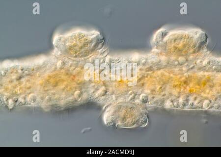 Hypotrich protozoans. Differential interference contrast micrograph of Kerona pediculus ciliate hypotrich protozoans (oval) on the tentacle (horizonta Stock Photo