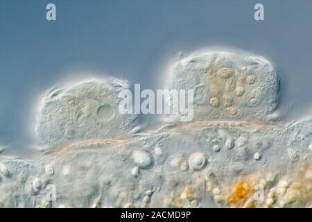 Hypotrich protozoans. Differential interference contrast micrograph of Kerona pediculus ciliate hypotrich protozoans (oval) on the tentacle (horizonta Stock Photo